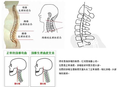 反弓|什么是颈椎“反弓”？一把尺就能告诉你颈椎好不好